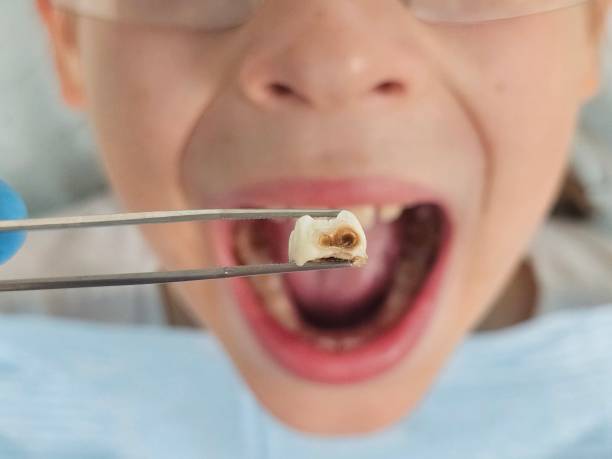 Best Emergency Cosmetic Dentistry (e.g., broken veneers) in Gladwin, MI